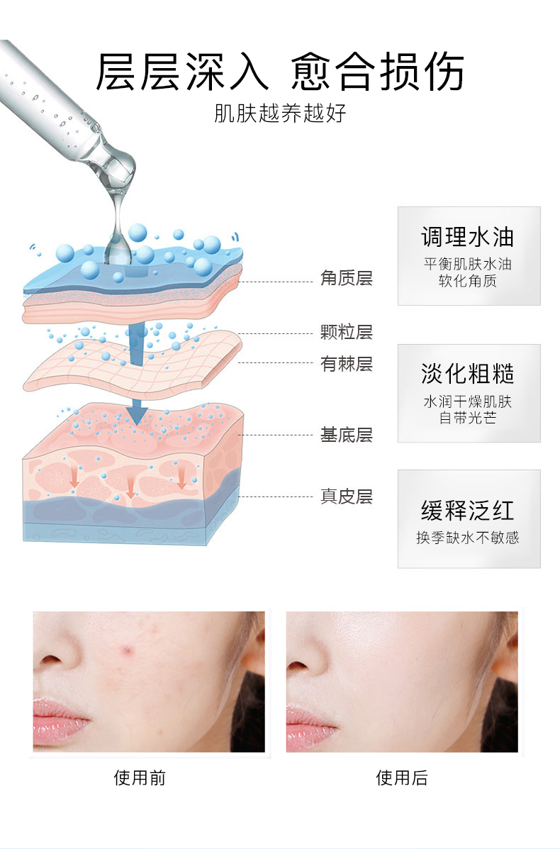 舒缓修护冻干粉套组详情页_09